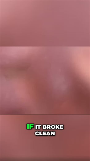 Mineral Gemstones on Instagram: "Quartz shatters randomly. Diamond? Perfect planes. Clean breaks. Precision cuts. A gem cutter's dream. #geology #diamonds #quartz #gemstones #crystals #science #minerals"