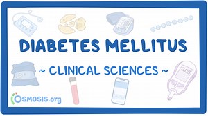 Diabetes mellitus (pediatrics): Video & Meaning | Osmosis