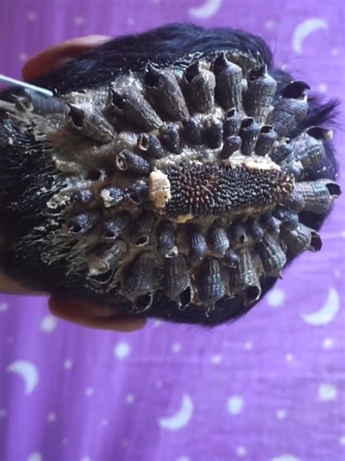 28K views · 123 reactions | Dandruff this satisfying removal #DandruffScratching #ItchyDryScalp #HugeFlakes #Dandruff #dandrufftreatment #satisfying #dandruffremoval #fblifestyle Disclaimer: Videos do not show original Dandruff,they are used for education purpose. Thank You,,, | Hit's | Facebook