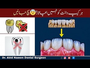 Types of Dental Crowns Explained| Which One is Best for You?