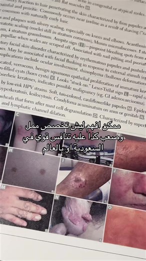 كلية الطب: تخصص الجلدية وتحديات التمريض