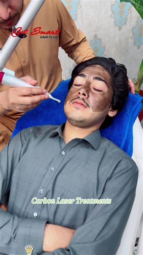 Effective Carbon Laser Treatments for Skin Rejuvenation