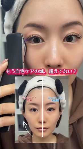 もう自宅ケアの域、超えてない？韓国式肌管理発想の美顔器✨『Brighte ELEKI LIFT』 #美容 #スキンケア #韓国美容 #アラフォー #美顔器