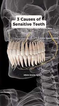 Did you know these are 3 common causes of SENSITIVE Teeth? Watch to find out! #teeth #tmj #neckpain