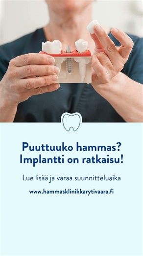 Hammasklinikka Rytivaara - Puuttuuko hammas? Implantti on ratkaisu!