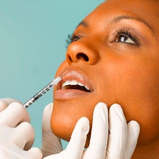 This is What Cheek Fillers Looks Like on 3 Different Women | The Plastics