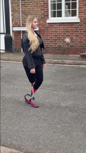 Incredible Double Amputee Girl Walking with Prosthetic Legs | Above & Below Knee Amputee Motivation