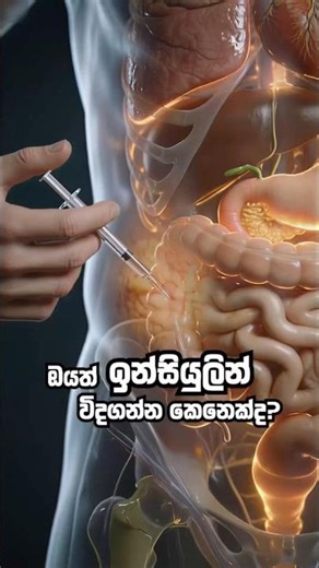 වේදනාවකින් තොරව ඉන්සියුලින් විදගන්නේ මෙන්න මෙහෙමයි! 💉🩹 | How to Inject Insulin