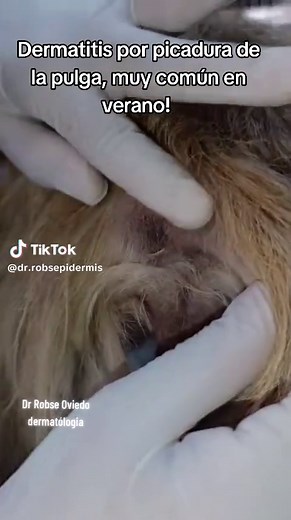 Dermatitis por picadura de pulga en verano