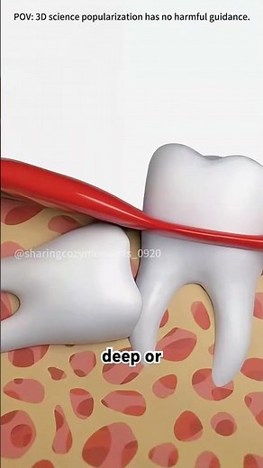 Tooth extraction procedure #drone #theflash #space