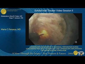 Laparoscopic Management of Duodenal Perforation during Concomitant Per-Oral Pyloroplasty and Laparoscopic Implantation of Gastric Electric Stimulator • Video • MEDtube.net