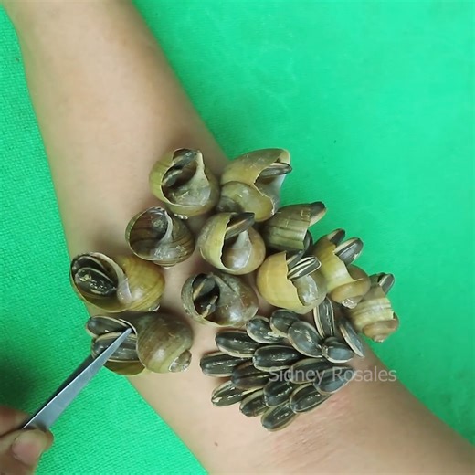 Help Removing And Picking a Ticks #Ticks #Remove #3123 | Sidney Rosales