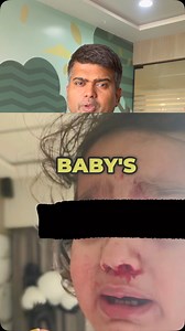 What to Do When Your Baby Has a Nosebleed We discuss what to do if your baby experiences a nosebleed, including keeping them upright, applying gentle pressure, and seeking medical attention if the bleeding persists for more than 10 minutes. 💥💥share your experience moms 💥💥in case of queries contact ur doctor! WhatsApp on 9825112855 for online consultation #NoseBleed #BabyHealth #emergencyprocedure #kids #moms #baby #moms #momsofinstagram #momswholift #momssupportingmoms #momstyle #momslife | 