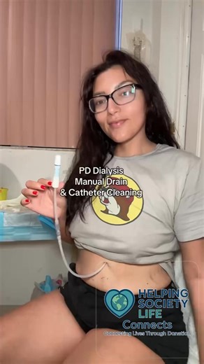🩺 Real Life on Peritoneal Dialysis (PD) This is what strength looks like — a patient Melanie performing her manual drain and catheter care with courage and consistency. 💪 Peritoneal dialysis allows patients to manage kidney failure from home, maintaining independence and routine with proper hygiene and medical support. ✨ Always clean hands. ✨ Keep the catheter site sterile. ✨ Follow your nephrologist’s instructions carefully. Every step matters — because every drop counts toward a healthier to