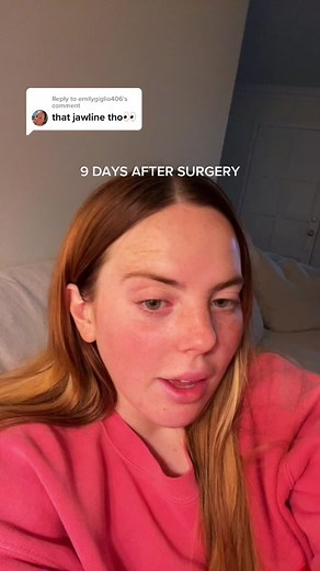 Chin Surgery Journey: 9 Days Post-Op Update