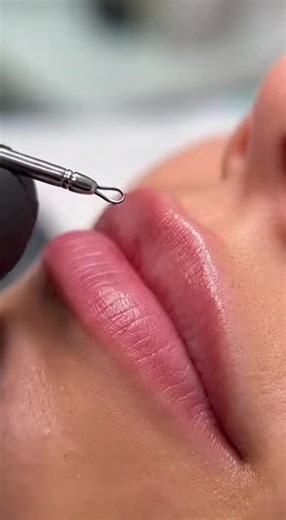 black heads remove for lips. #viral #faceclean #creatorsearchinsights #facecleaning #removeblackheads