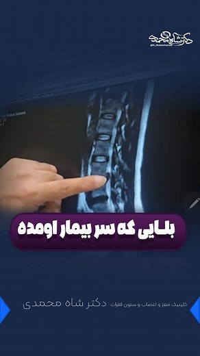 ‎دكترشاه محمدی | جراح و متخصص مغزواعصاب و ستون فقرات‎ on Instagram‎: ". 🚨 آیا می‌دانید دیسک پاره شده نه تنها درد شدید ایجاد می‌کند بلکه می‌تواند به ریشه‌های عصبی آسیب برساند و مشکلات جدی مثل فلجی پا، اختلال ادرار و مشکلات جنسی به وجود آورد؟ 🧠🦵 بسیاری از بیماران با درد کمر و سیاتیک به مطب مراجعه می‌کنند و سوال اصلی‌شان این است که "آیا عمل جراحی لازم است؟" من به عنوان جراح مغز و اعصاب اینجا هستم تا با شما شفاف صحبت کنم: ۸۰٪ دیسک‌های کمر نیازی به جراحی ندارند، ولی تشخیص درست این موضوع تنها بر عه