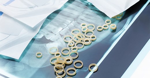 Invisalign Rubber Bands: Who Needs Them and What They Do