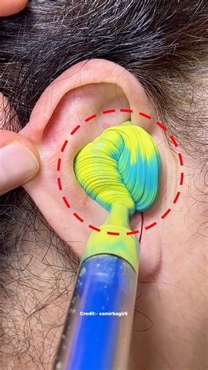 what's being put into this Girl's Ear?