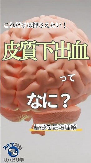 【基礎】皮質下出血ってなに？PTなら知っておきたい基礎 #理学療法士国家試験 #理学療法士 #作業療法士国家試験 #作業療法士 #基礎 #脳 #脳出血 #脳卒中 #皮質下出血