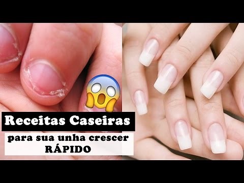 3 receitas caseiras para sua unha crescer RÁPIDO