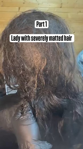 1.5K views · 32 reactions | This lady doesn't have lice. I saw her last year when she did have a severe lice infestation as well as matted hair. Unfortunately her has become matted again so she is back in clinic today! She came for her 1st appointment today, some good progress was made. It will most likely need around 7 hours work. #hair #reels #fyp #reels ##mattedhair #hairtransformation #mentalhealth | Nit Nurse | Facebook