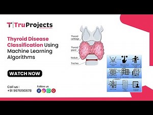 Thyroid Disease Classification Using Machine Learning Algorithms