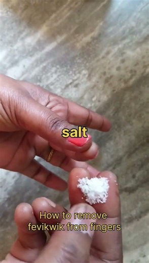New trick unlocked how to remove fevikwik from fingers ###trythisidea ##usefultip ##ytshorts