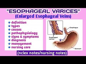 Esophageal Varices| Types| Causes| Pathophysiology| Symptoms| Diagnosis| Management| Nursing care