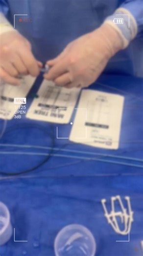 Coronary Angioplasty Balloon Explained