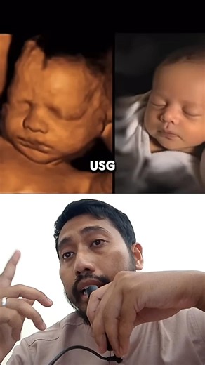 2D, 3D, 4D Ultrasound ⁉️🤔 What's the difference? #drbimo #healthfacts #education #unique-facts
