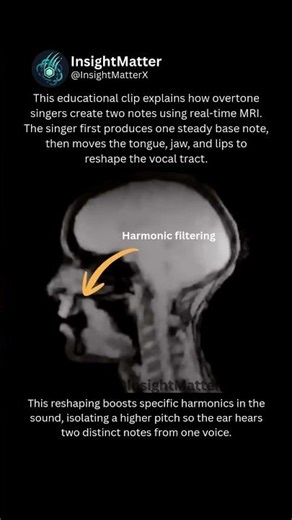 What Overtone Singing Looks Like Inside an MRI