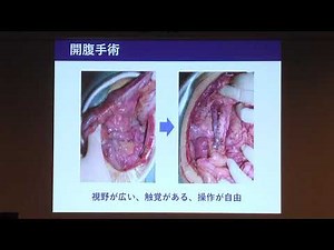 令和2年1月25日②「直腸がんに対するロボット手術」（消化器外科医長 大野 吏輝 ）