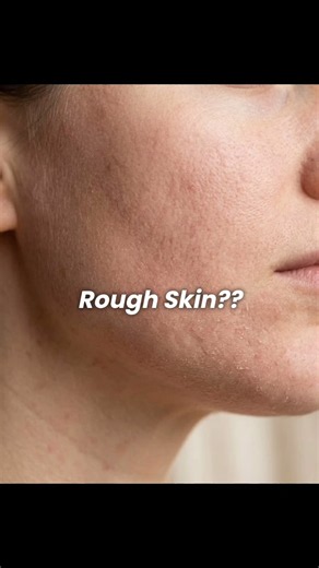 Rough Skin? Try This!