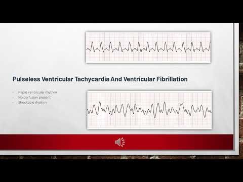 DiLorenzo_Part-3 RT-ACLS Advanced EKG & Defibrillation for Respiratory Therapists