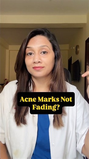 Acne Marks NOT Fading? 🚨 Stop These 5 Mistakes | Dark Spots & Pigmentation