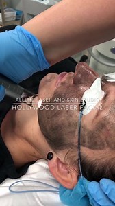 3.9K views · 38 reactions | Hollywood Laser Facial [Turn on HD to...