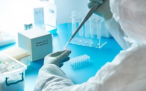 Phòng PCR là gì? Thiết kế phòng xét nghiệm sinh học phân tử thế nào