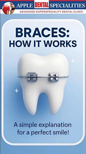 Straighten Your Smile, One Step at a Time