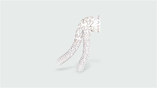 EXCLUDER® Conformable AAA | Gore Medical EMEA