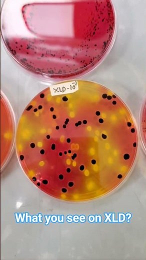Salmonella Colonies on XLD Agar | Xylose Lysine Deoxycholate Medium #shorts #microbiology #lab