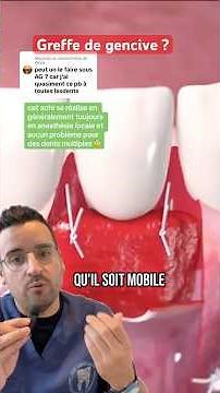Gencives en recul ? Pourquoi la greffe gingivale peut sauver le sourire !