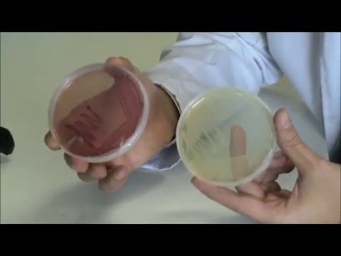 Técnicas básicas de Microbiología: Morfología de Escherichia coli en diferentes medios de cultivo