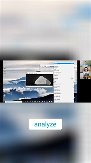 Measure ANYTHING! ImageJ's Tooth Size Trick!