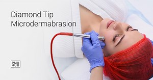 Diamond Microdermabrasion - All You Need to Know