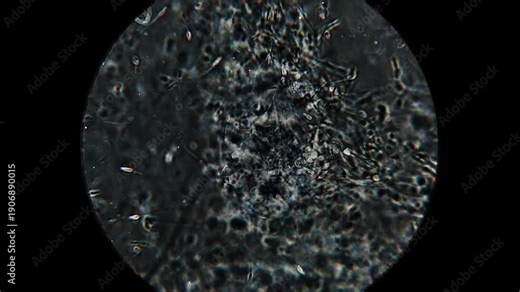 Real footage of human sperm under a light microscope 100x fertilizing an egg cell moving fast 4K HQ