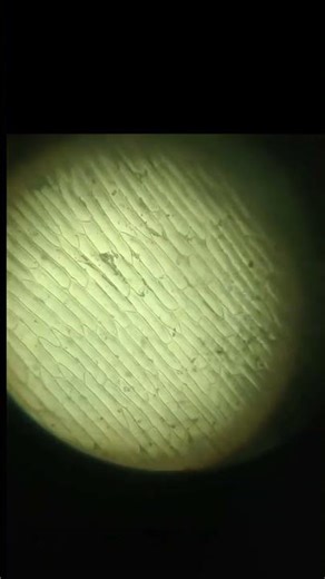 Onion peel under microscope 🔬