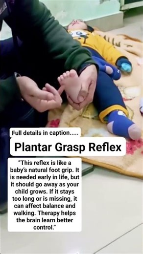 Plantar Grasp Reflex Explained 👣 | Why Therapists Check This Foot Reflex | Child Development |