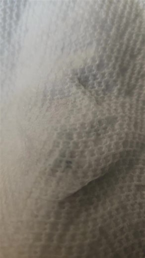 did this little guy on my wrist but didn't leave enough gap between the design. I still like it though. it's not bruised it's stencil #sharktattoo #tattoos #fyp