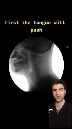 What EATING Looks Like On X-Ray 😱
